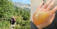 Po Slovensku sa šíri NAJNEBEZPEČNEJŠIA rastlina. Spôsobuje bublinové pľuzgiere, no bolesť najskôr nepocítiš hodiny